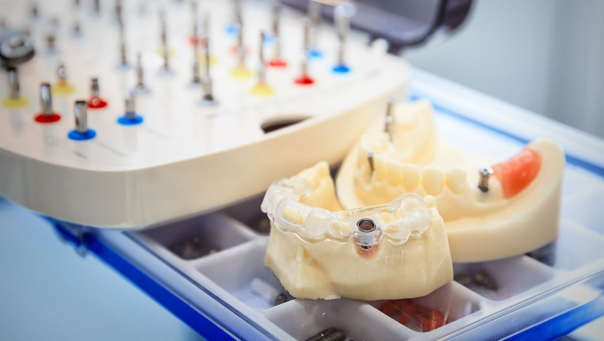 moldes protesis dental en laboratorio