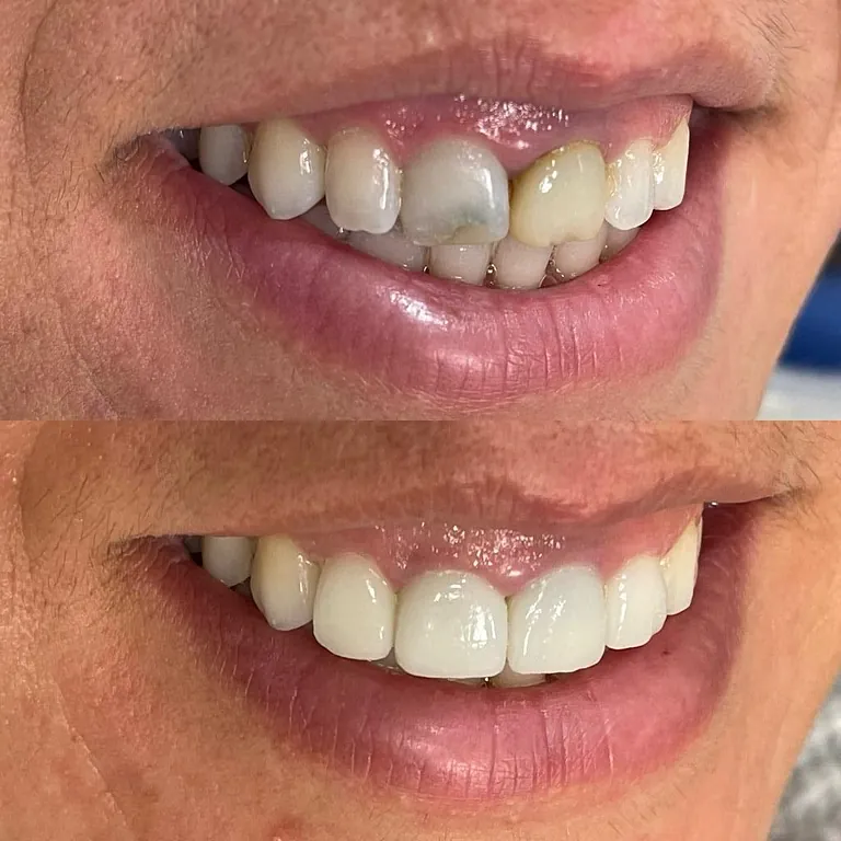 NATURAL TEETH SL. Dientes 2