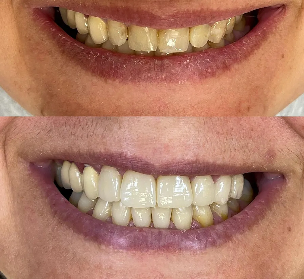 NATURAL TEETH SL. Dientes 2